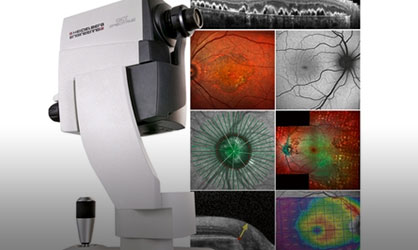 3 OCT Spectralis, Heidelberg